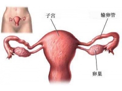 精索静脉曲张