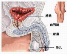 性欲障碍怎么检查?